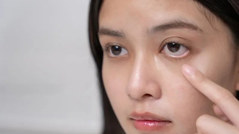 dark eye circles