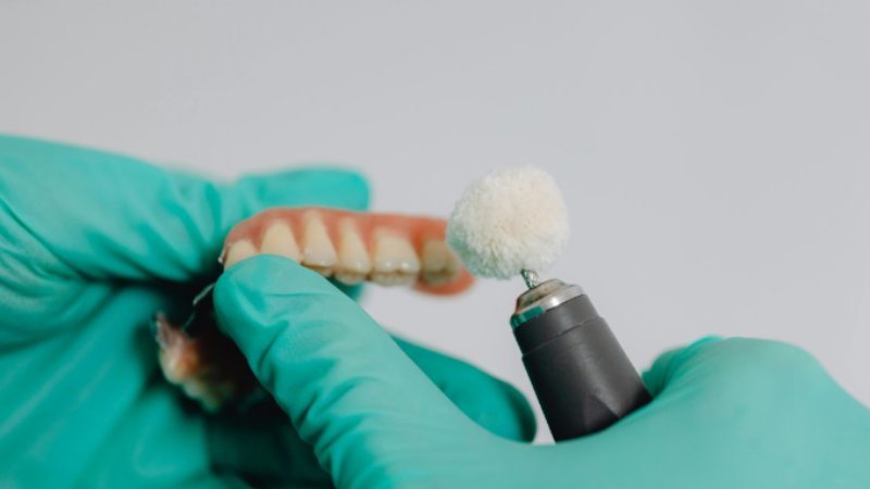 Full Dentures Lower Hutt