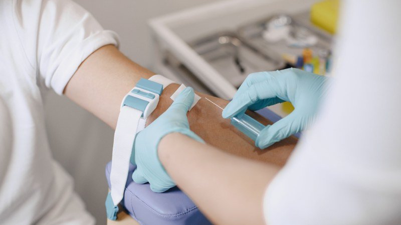 Alzheimer's Blood Test