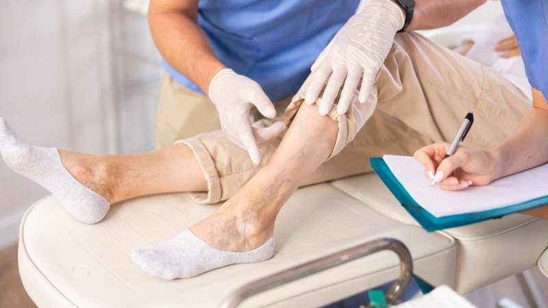 How Vein Doctors Build Personalized Plans for Your Leg Health