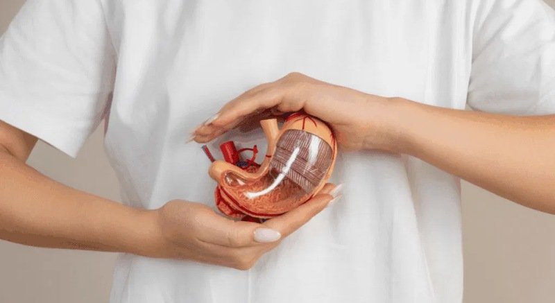 Is Gastric Sleeve Permanent