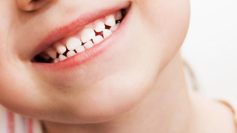 Bad Habits for Teeth That Affect Your Child's Smile and How to Stop Them